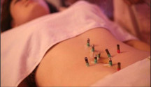 Moxa Moxabust�o Mini Acupuntura Tubo Auto-adesivo 45 Pe�as